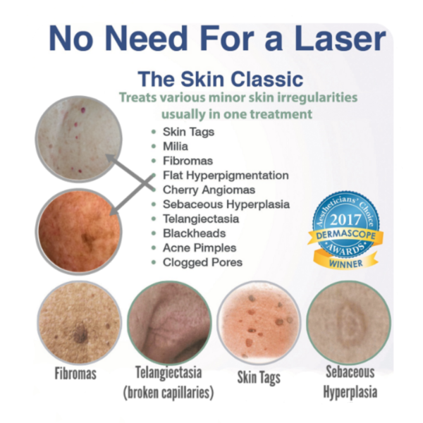 skin classic treatment  LORI NAON